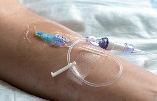 Close up of a medical infusion